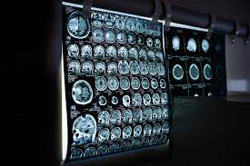 neuro